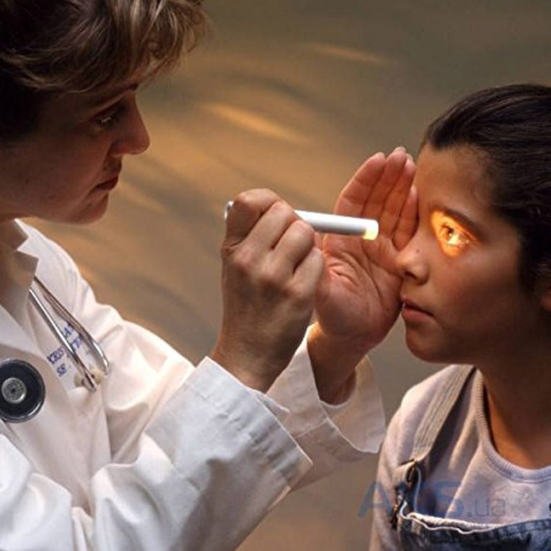 светят фонариком в глаза. что будет если светить лазером в глаз. исследование зрачка на свет. светил фонариком в глаз. светил фонариком в глаз.